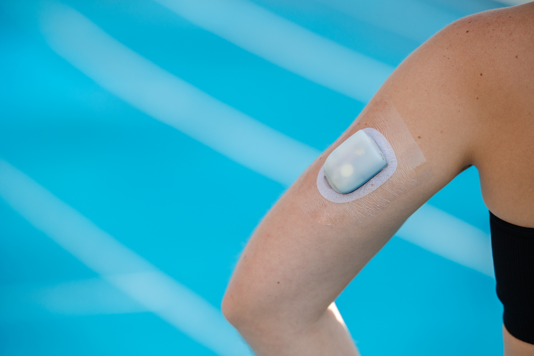 Omnipod 5: Do You Need a Special Patch? - Type Strong