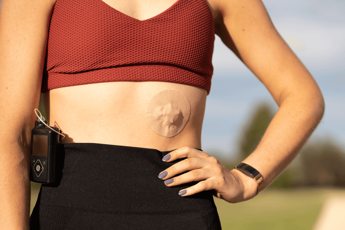 Navigating Life After a Diabetes Diagnosis: Guidance and Support from Type Strong - Type Strong