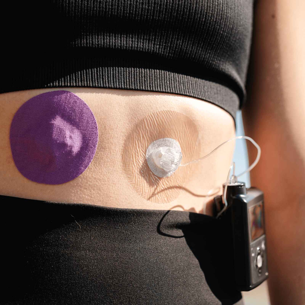 Pump Infusion Set Adhesive Patches - Skin Safe | 7+ Day Hold, 20 Pack